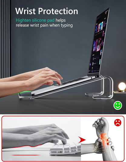 JCZT Aluminum Laptop Stand, Notebook Stand with Wrist Rest, Ergonomic Detachable Laptop Mount, Computer Stand Compatible with 10-17'' All Laptops Such as MacBook Air Pro/HP/Dell/Lenovo, Gold