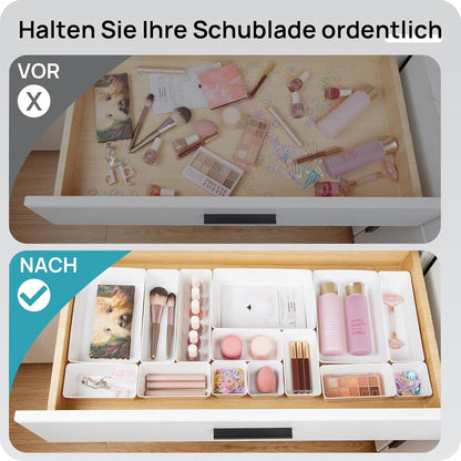 Vtopmart 25 PCS Clear Plastic Drawer Organizers Set, 4-Size Versatile Bathroom and Vanity Drawer Organizer Trays, Storage Bins for Makeup, Bedroom, Kitchen Gadgets Utensils and Office