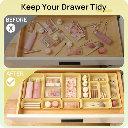Vtopmart 25 PCS Clear Plastic Drawer Organizers Set, 4-Size Versatile Bathroom and Vanity Drawer Organizer Trays, Storage Bins for Makeup, Bedroom, Kitchen Gadgets Utensils and Office